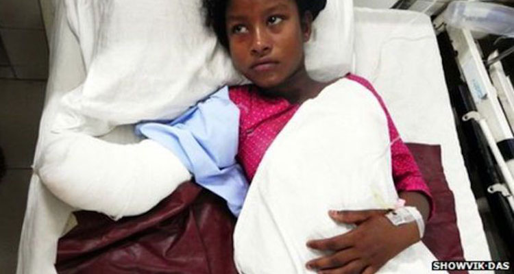Aana Akhter says if her hand had not been amputated she would never have survived (Image Courtesy of lateet.com) 